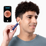 Limpiador de Oídos inteligente con cámara HD, Bebird  Earsight Plus D39r ORIGINAL (Otoscopio)